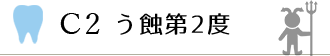 C2 う蝕第2度